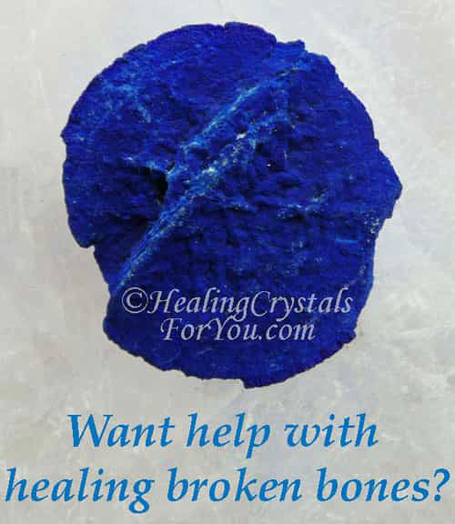 Healing Broken Bones