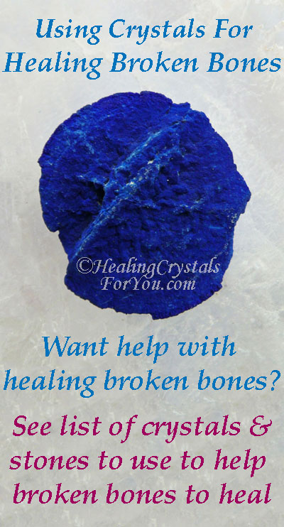 Healing Broken Bones