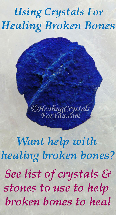 Healing Broken Bones Healing Broken Bones